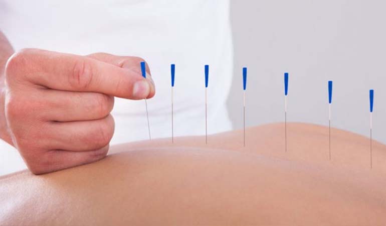 DIPLOMA IN ACUPUNCTURE